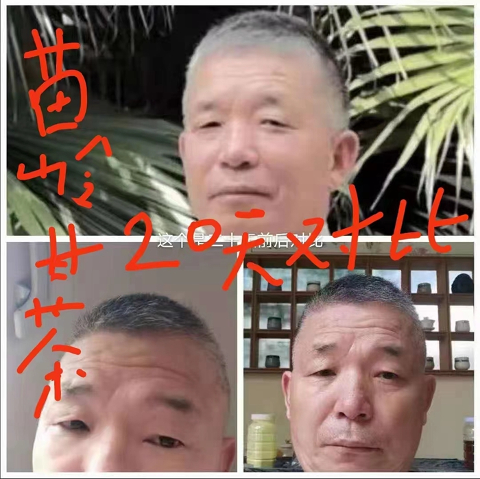 高級反射蜂療專家范景良 高級反射蜂療專家范景良